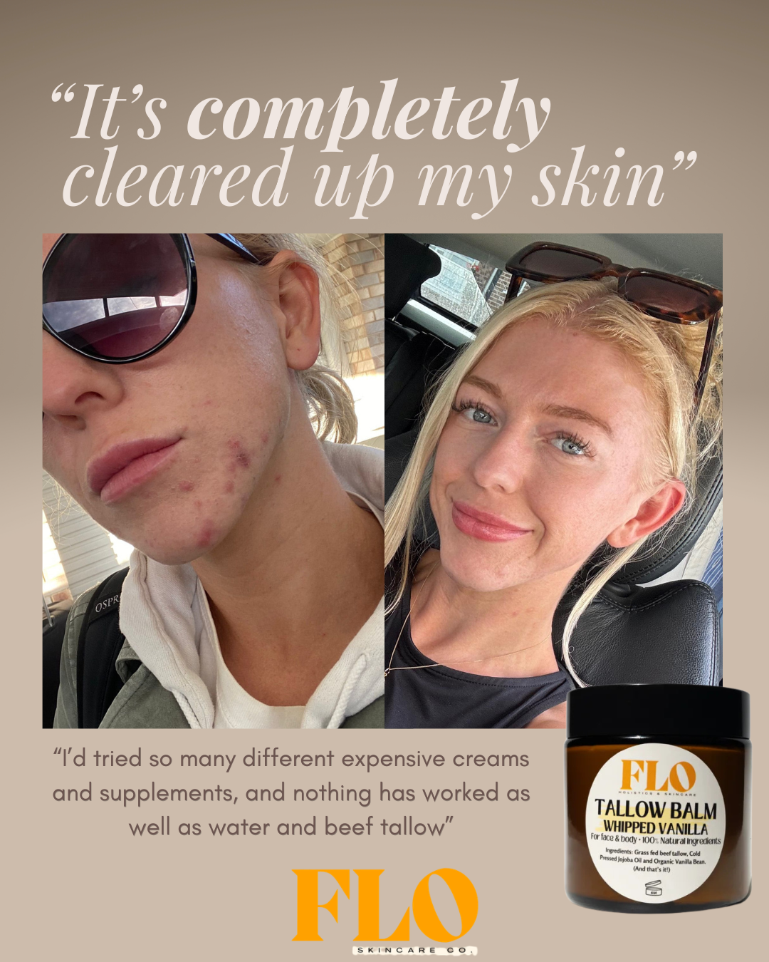 Tallow Balm - Whipped Vanilla