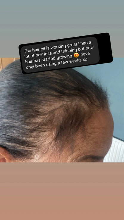 Hair Oil